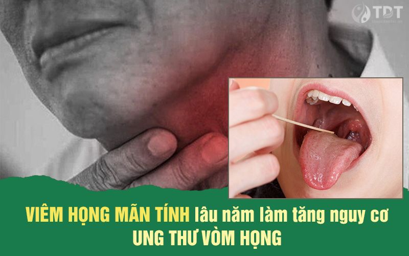 Viêm họng mãn tính làm tăng nguy cơ ung thư vòm họng