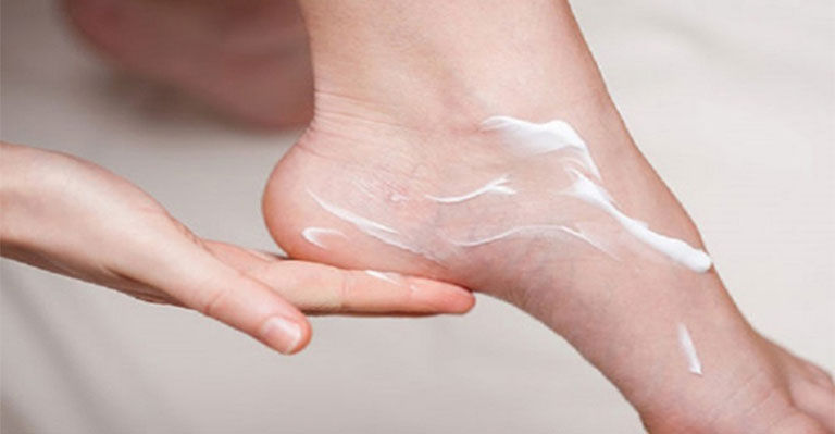 Bệnh tổ đỉa ở chân: Hình ảnh nhận biết và cách điều trị dứt điểm