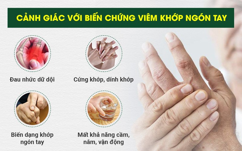 Viêm đau khớp ngón tay: Nguyên nhân, dấu hiệu và điều trị