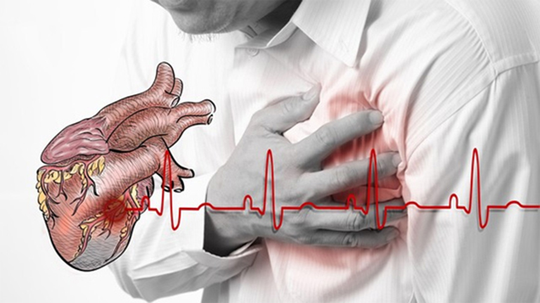 Bệnh phong thấp gây ra các biến chứng ảnh hưởng đến hệ thống tim mạch của người bệnh