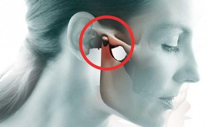 Khi nhai có tiếng kêu trong tai là bị gì?
