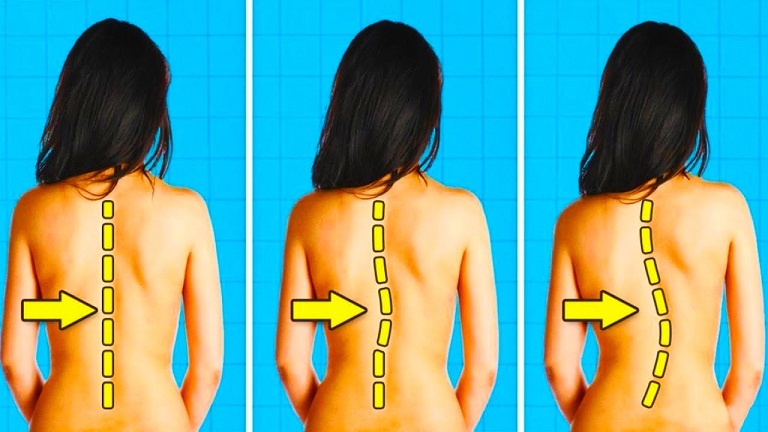 Đau vùng lưng dưới bả vai bên trái – Dấu hiệu của nhiều bệnh lý