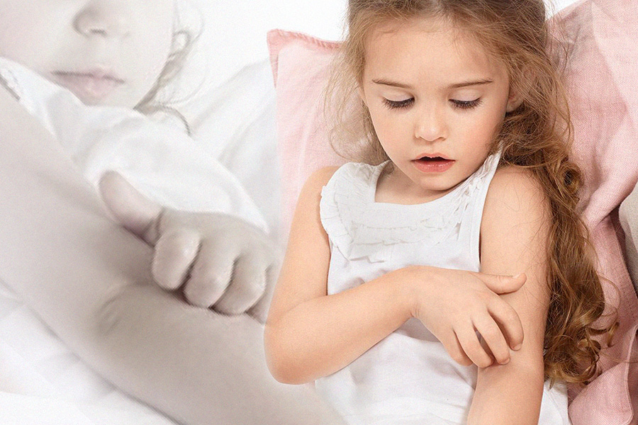 Mẩn ngứa ở trẻ em và cách chữa hiệu quả nhất từ thảo dược thiên nhiên
