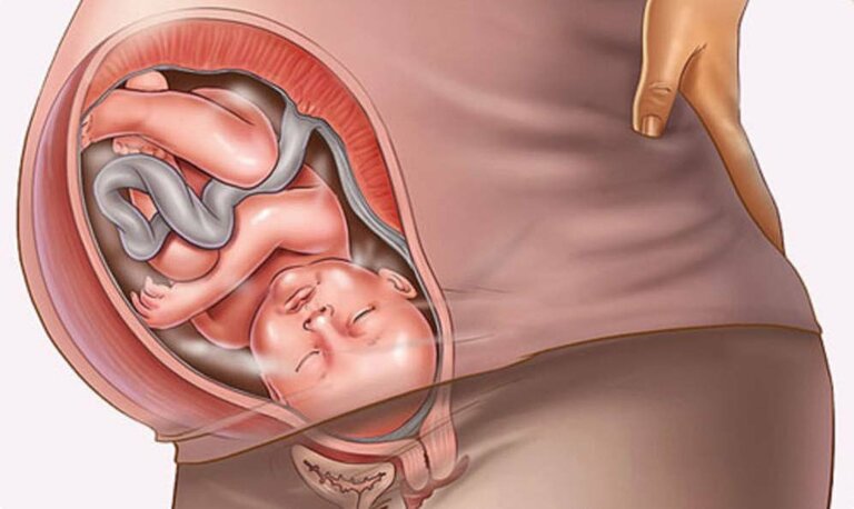 Nguyên nhân phổ biến gây tiểu rắt ở phụ nữ mang thai là sự thay đổi nội tiết tố và bàng quang người mẹ bị thai nhi chèn ép