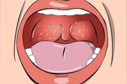 Nổi mụn trắng trong cổ họng có thể là dấu hiệu cảnh báo nhiều bệnh nguy hiểm