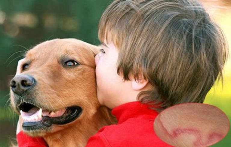 Hạn chế ôm hôn chó để tránh lây nhiễm giun sán