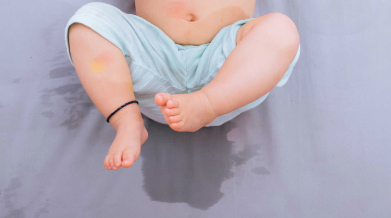 Són tiểu ở trẻ là tình trạng trẻ tiểu không tự chủ.