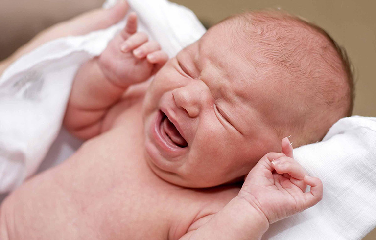 Trẻ sơ sinh bị viêm amidan và những điều cần lưu ý