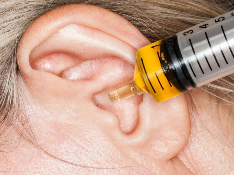 Vệ sinh tai sạch sẽ trước khi tiến hành xông hương để mang lại hiệu quả điều trị tốt