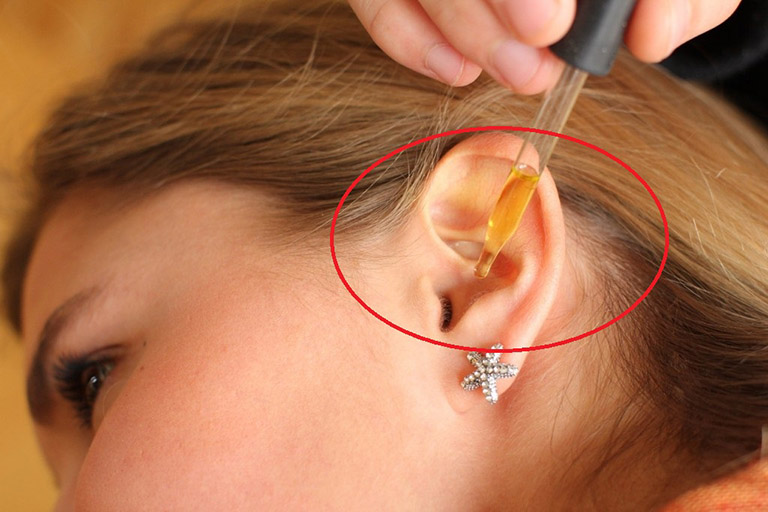Viêm ống tai ngoài (tai ngoài bị nhiễm trùng) và cách điều trị