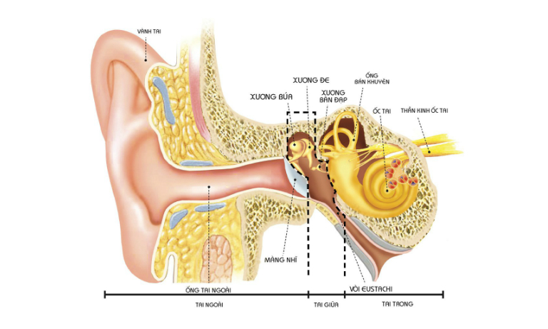 Viêm tai giữa là tình trạng tổn thương và nhiễm trùng vùng tai ở sau màng nhĩ.
