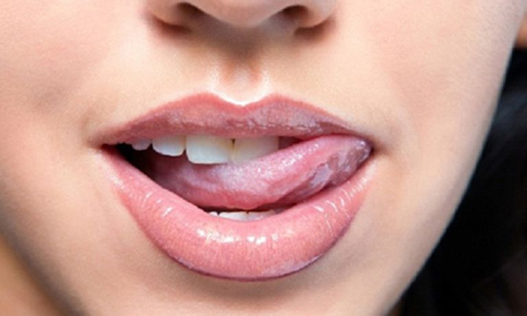 Bệnh lậu ở miệng là căn bệnh nhiễm trùng sinh dục ở vùng miệng do song cầu khuẩn lậu gây ra