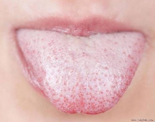 Có nhiều nguyên nhân gây ra hiện tượng lưỡi trắng hôi miệng