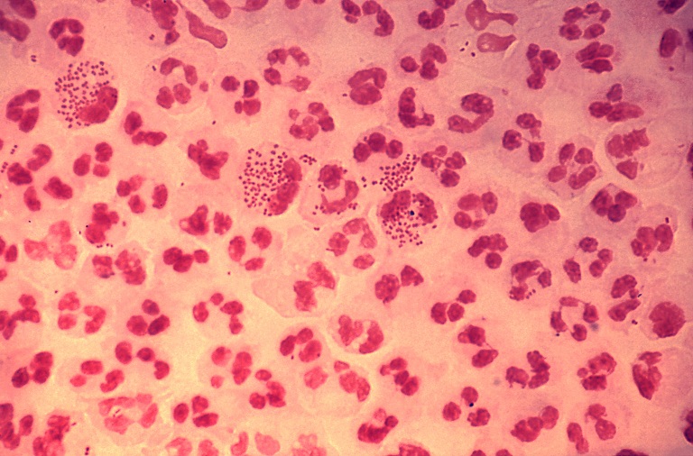Neisseria gonorrhoeae là gì