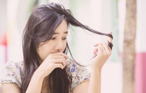 Nếu tóc rụng hơn 100 sợi một ngày (kể cả vào mùa rụng tóc) thì đó là dấu hiệu của bệnh lý