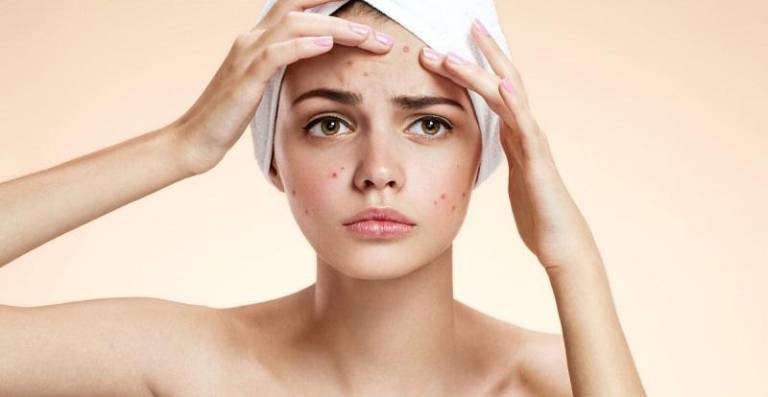 Dị ứng da mặt do nhiều nguyên nhân gây ra có thể được điều trị bằng thuốc hoặc không