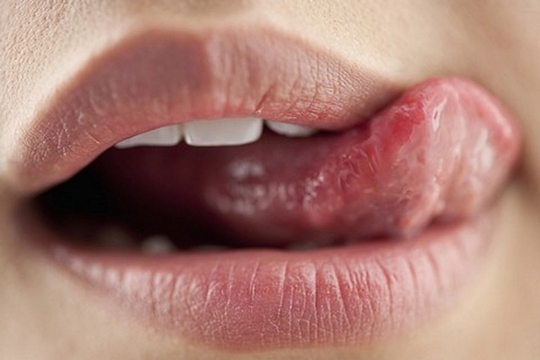Chia Sẻ Cách khắc phục phun môi bị ngứa viền môi hiệu quả