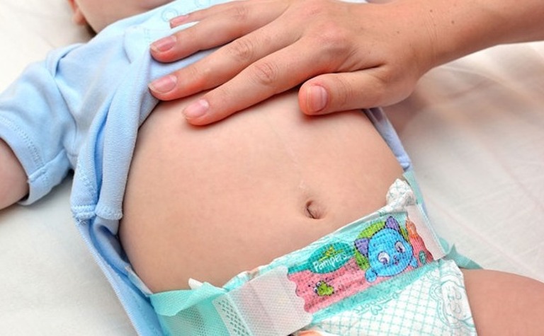 Trẻ sơ sinh rất dễ gặp các vấn đề về rối loạn tiêu hóa, trong đó có chứng táo bón