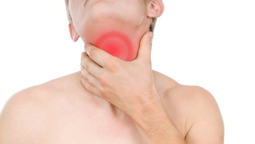 Viêm họng đỏ là chứng viêm họng cấp tính.