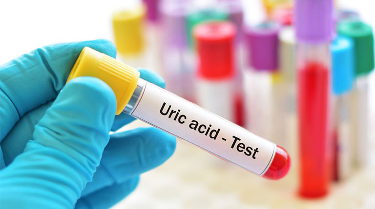 định lượng acid uric