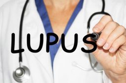 bệnh lupus ban đỏ có chữa được không?