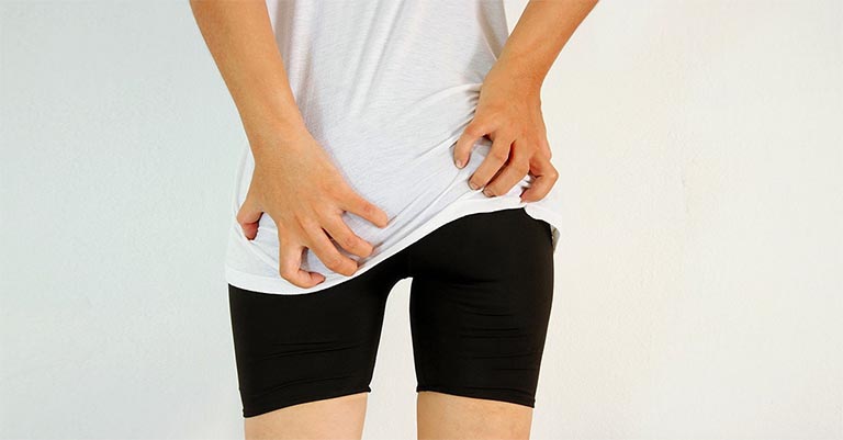 Bị ghẻ ở mông (vùng kín) và cách điều trị nhanh nhất