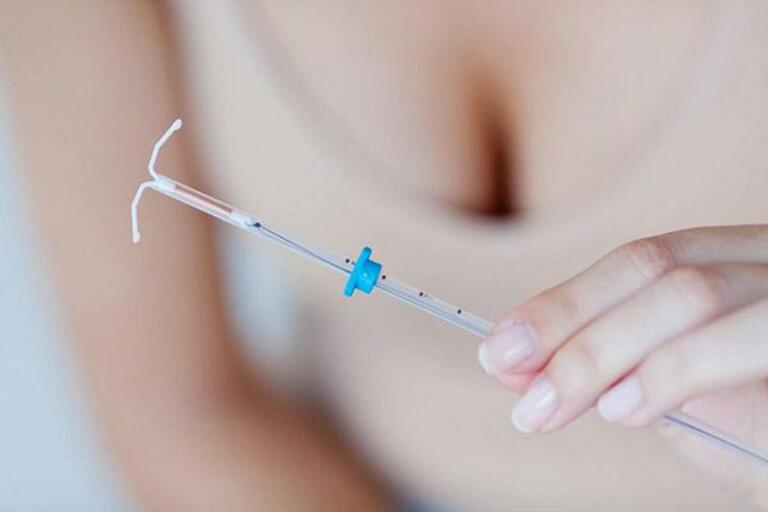 Biện pháp tránh thai cho người u xơ tử cung
