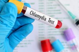 xét nghiệm Chlamydia