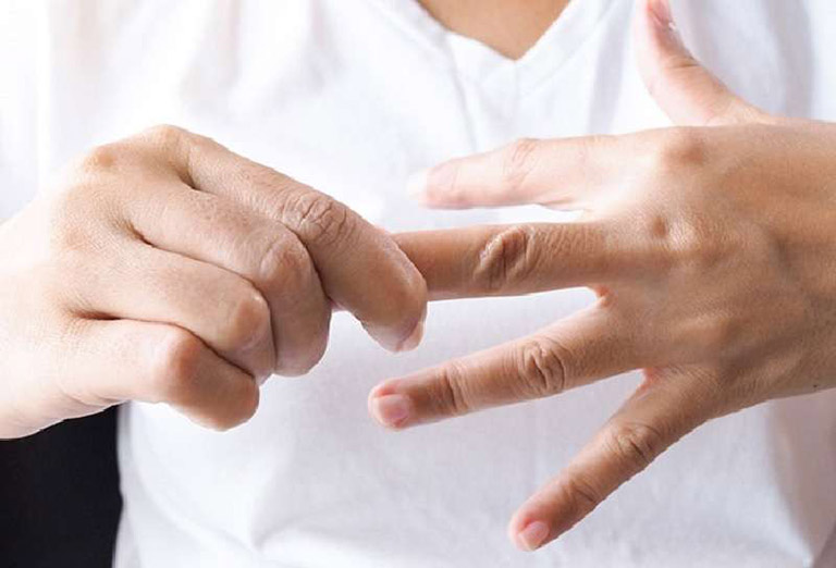 Bị nước ăn tay – Cách đặc trị tại nhà và thuốc bôi