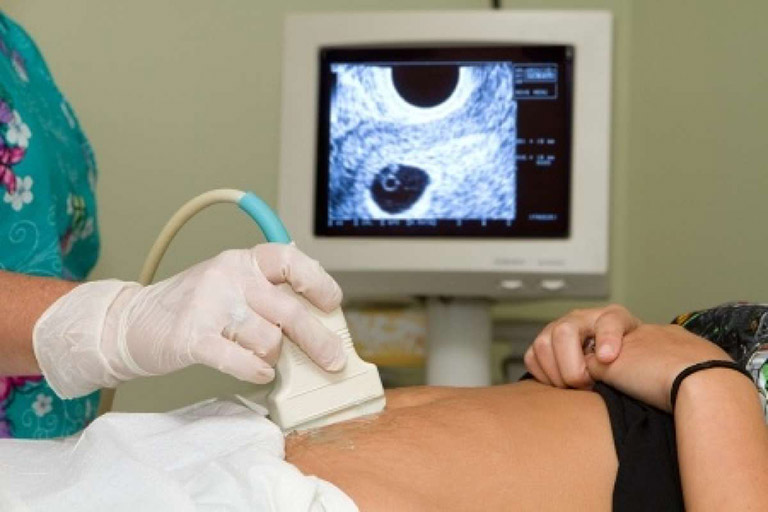 Mang thai ngoài tử cung siêu âm có thấy không?