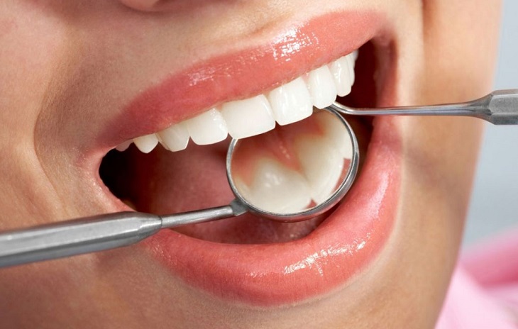 Dù đau răng kiêng ăn gì thì cũng đừng quên vệ sinh răng miệng sạch sẽ