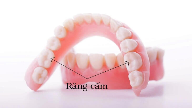 Răng hàm số 6 hay còn gọi là răng cấm có vai trò rất quan trọng trong chức năng ăn nhai