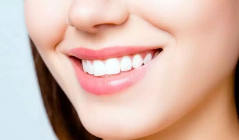 Trồng răng sứ cần áp dụng quy trình chuẩn nha khoa