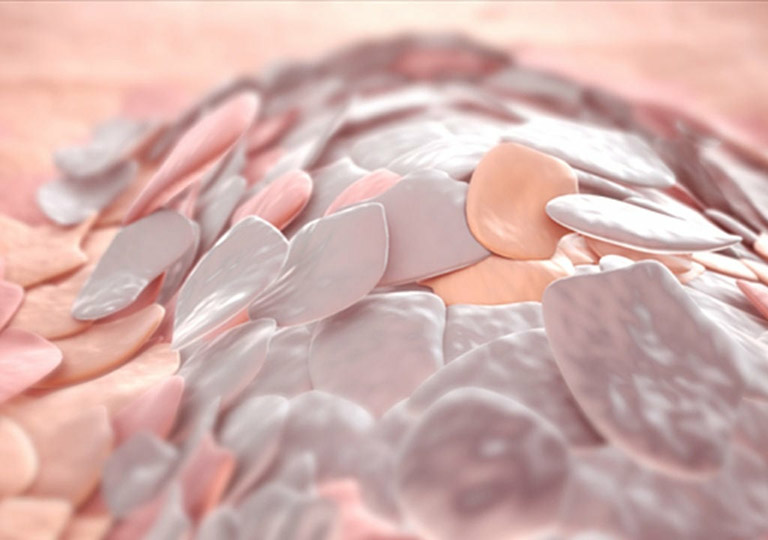 Chi tiết về phương pháp trị vảy nến bằng tế bào gốc