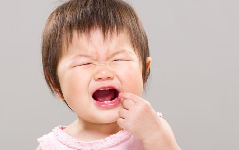 Răng nhạy cảm bẩm sinh dễ bị ê buốt do ăn đồ quá chua, quá nóng hoặc quá lạnh