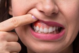 Bọc răng sứ có đau không?