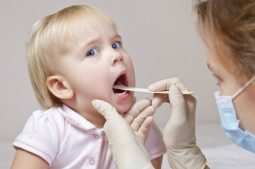 Trẻ bị sâu răng cần được điều trị đúng cách