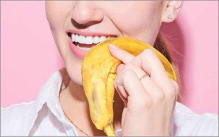 Làm trắng răng bằng vỏ chuối chỉ thích hợp với trường hợp răng ngả vàng nhẹ