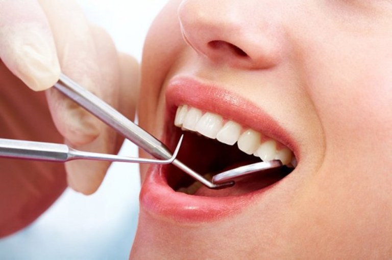 Quy trình lấy cao răng tương đối đơn giản và nhanh chóng