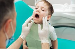 Lấy tủy răng sữa ở trẻ được chỉ định cho trường hợp trẻ bị sâu răng, viêm tủy răng nghiêm trọng