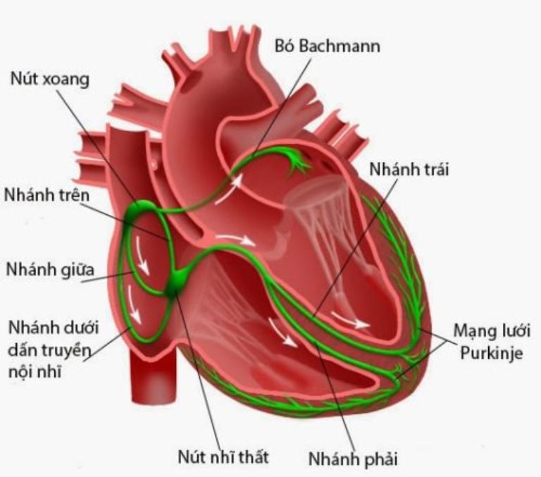 Nhồi máu cơ tim block nhánh phải là tình trạng không hiếm gặp