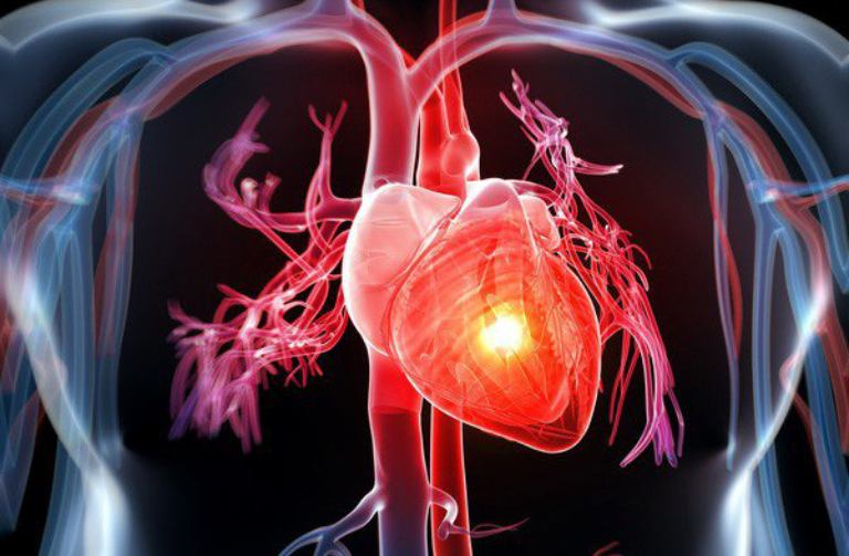 Bệnh tim mạch là một trong những nhóm bệnh không truyền nhiễm có tỷ lệ tử vong cao nhất hiện nay
