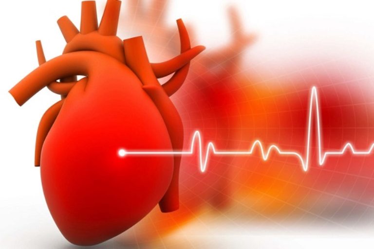 Rối loạn nhịp tim có thể là nguyên nhân khiến cơ tim bị phì đại