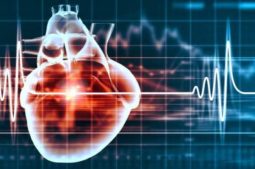 Trụy tim mạch là căn bệnh xảy ra khi hệ thống điện tim hoạt động bất thường