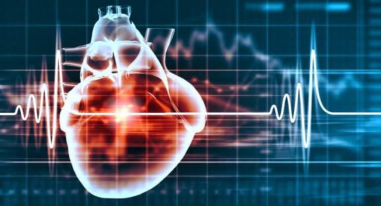 Trụy tim mạch là căn bệnh xảy ra khi hệ thống điện tim hoạt động bất thường