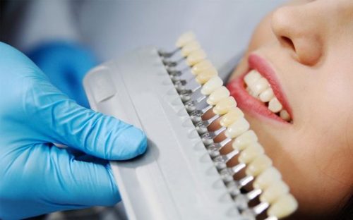 Quy trình bọc răng sứ không đau tại ViDental Clinic